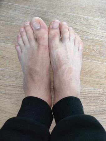Feetadele Голые слитые фото OnlyFans 1